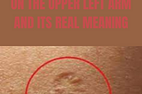 Do You Know The Truth Behind The Small Scar On The Upper Left Arm And Its Real Meaning