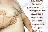 Is Gynecomastia Surgery Costly?