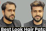 Top Hair Patches in Ranchi | Top Hair Wig Shop in Ranchi