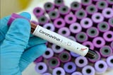 Is a Headache a Symptom of Coronavirus? Here’s What Experts Say