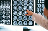 Head CT Foundation Model Outperforms Commercial Alternatives, Detects Diseases Beyond Hemorrhage