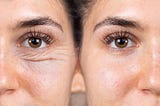Are You Making These Mistakes? Causes of Eye Wrinkles Revealed!