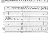Brief Review — Development of the polysomnographic database on CD-ROM