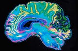 Male and Female Brain Anatomy: A Continuum Rather than a Binary