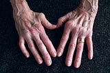 Rheumatoid Arthritis Causes , Diagnosis and Symptoms