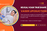 Vaser Liposuction Surgery in Gurgaon