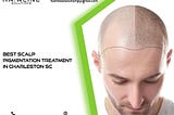 Best Scalp Pigmentation Treatment in Charleston SC