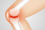 What to Look for in the Best Knee Replacement Surgeon in Delhi