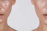 Stop Blaming Your Skin — Here’s What’s Actually Making It Oily