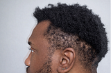 Afro-textured hair showing natural curl pattern and visible scalp areas, illustrating how visual density may differ from measured follicular density.