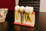 What is Dental Implant Surgery?