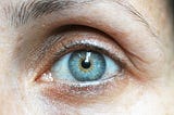 Close up of woman’s eye. Her eye is blue and the white of her eye has a blue tinge.