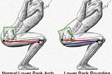 Beware of the wrong diagnosis! — Buttwink and Posterior Pelvic Tilt during the squat