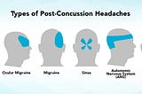 Concussion Headaches or “Post-Traumatic Headaches”: What They Feel Like, How Long They Last, and…