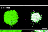 An Unknown Aspect of Tumour Microenvironment