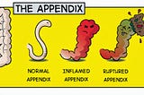 Journal Club: Is the Appendectomy the Next Surgery on the Chopping Block?