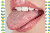 15 Compelling Home Remedies For Oral Thrush