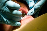 Most Common Dental Problems