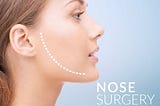 What is the Procedure of Rhinoplasty?