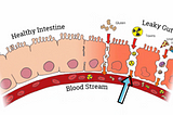 The Candida Diet and my 30 day experience