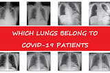 COVID-19 Detection in X-ray Images with Pytorch