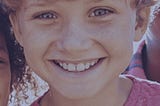 Unlocking Your Perfect Smile: Non-Extraction Treatment in Northridge
