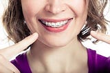 Learn About the Different Teeth Alignment Solutions from Your Trusted Orthodontist