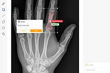 Medical Image Annotation — A UX Case Study