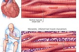 Myocarditis after vaccination against COVID