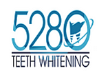 Tips For Finding Affordable Mobile Teeth Whitening Services