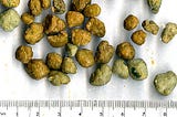 Namuong Bato sa Apdo o Gallstones — Narito ang Natural at Mas Ligtas na Paraan Upang Matanggal Ang…