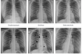 Lakera releases robustness testing suite for radiology AI teams.