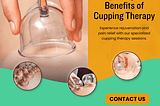 Cupping (Vacuum) massage with cups is the safest and most effective procedure.
