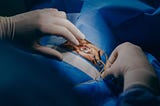 Cataract Surgery in Ahmedabad — Regain Clear Vision