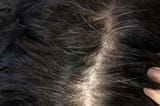 A close-up on the part of the author’s hair. They have a white scalp and dark brown hair, with a significant number of grey roots coming through.