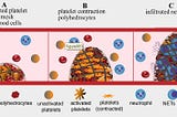 Histologia trombilor: de la imagistica la tromb si de la tromb la etiologia AVC