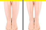 How To Get Rid Of Cankles (Swollen Ankles) EASILY, Fast At Home