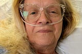 Colon Cancer Surgery Update
