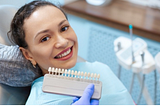 What Are Dental Veneers & Its Cost