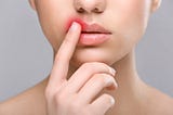 The Strange Link Between Cold Sores and Alzheimer’s Disease
