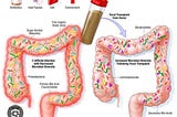 Fecal Microbiota Transplant (FMT): Process, Indication, Outcome