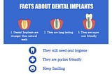 The Essentials of Dental Implants: Strength, Longevity, and Ease of Care | Best Dental Implants In…