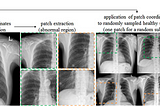 Deep Learning in Medical Imaging with small data