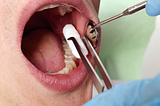 Exploring 7 Benefits of Comprehensive Exams in Dentistry