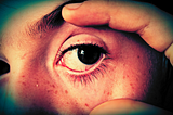 A person holding their eye open.