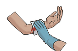 Handling Wounds and Severe Bleeding