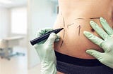 Liposuction Surgery — Know the Treatment Methods and How to Find the Right one