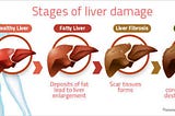 Fatty liver