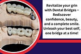 Revitalize your grin with Dental Bridges — Rediscover confidence, beauty, and a complete smile.