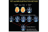 Decoding the Brain by Coding (2)